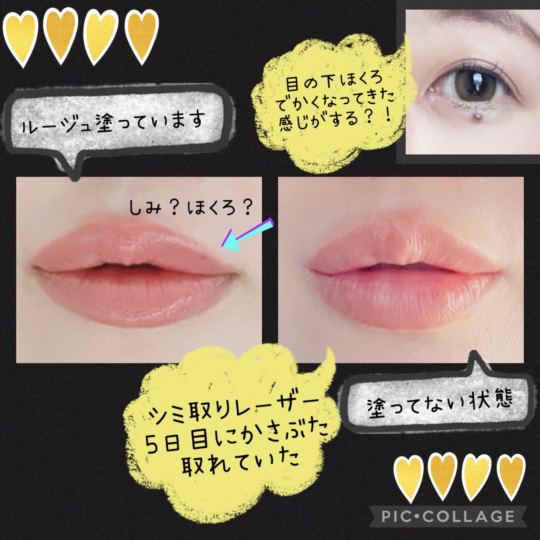 口紅がいらない薬用モイストリップ/メンターム/リップクリームを使ったクチコミ（1枚目）