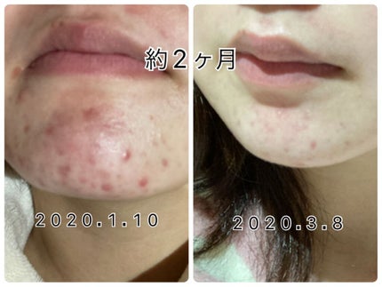 を使ったクチコミ(2枚目)