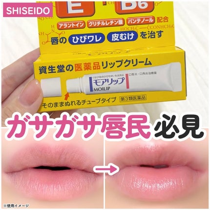モアリップ N (医薬品)/資生堂薬品/その他を使ったクチコミ(1枚目)