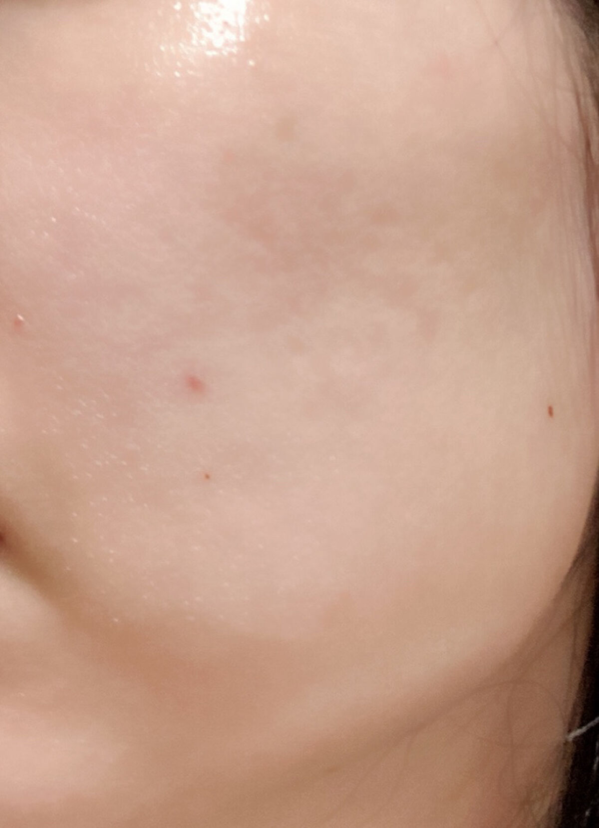 ピュアショット エッセンス ローション/YVES SAINT LAURENT BEAUTE/化粧水を使ったクチコミ（2枚目）