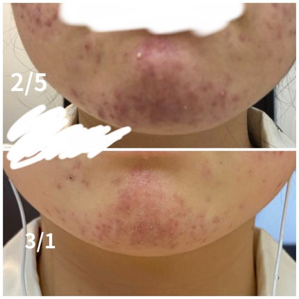 を使ったクチコミ(3枚目)