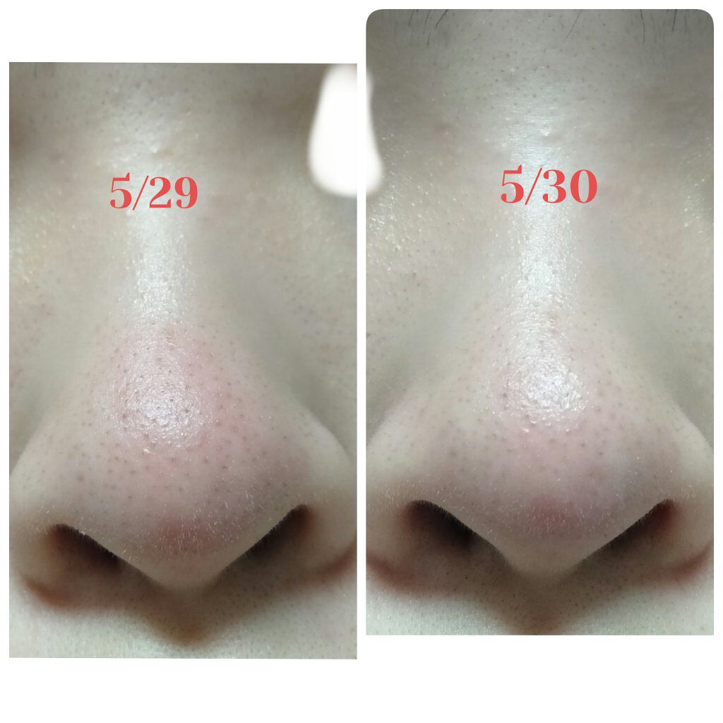 薬用しみ対策 美白化粧水/メラノCC/化粧水を使ったクチコミ(4枚目)