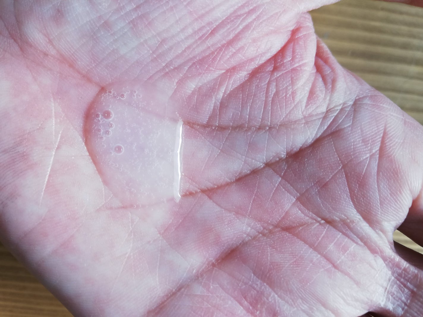 プロバイオダーム リペア スキントナー/BIOHEAL BOH/化粧水を使ったクチコミ(2枚目)