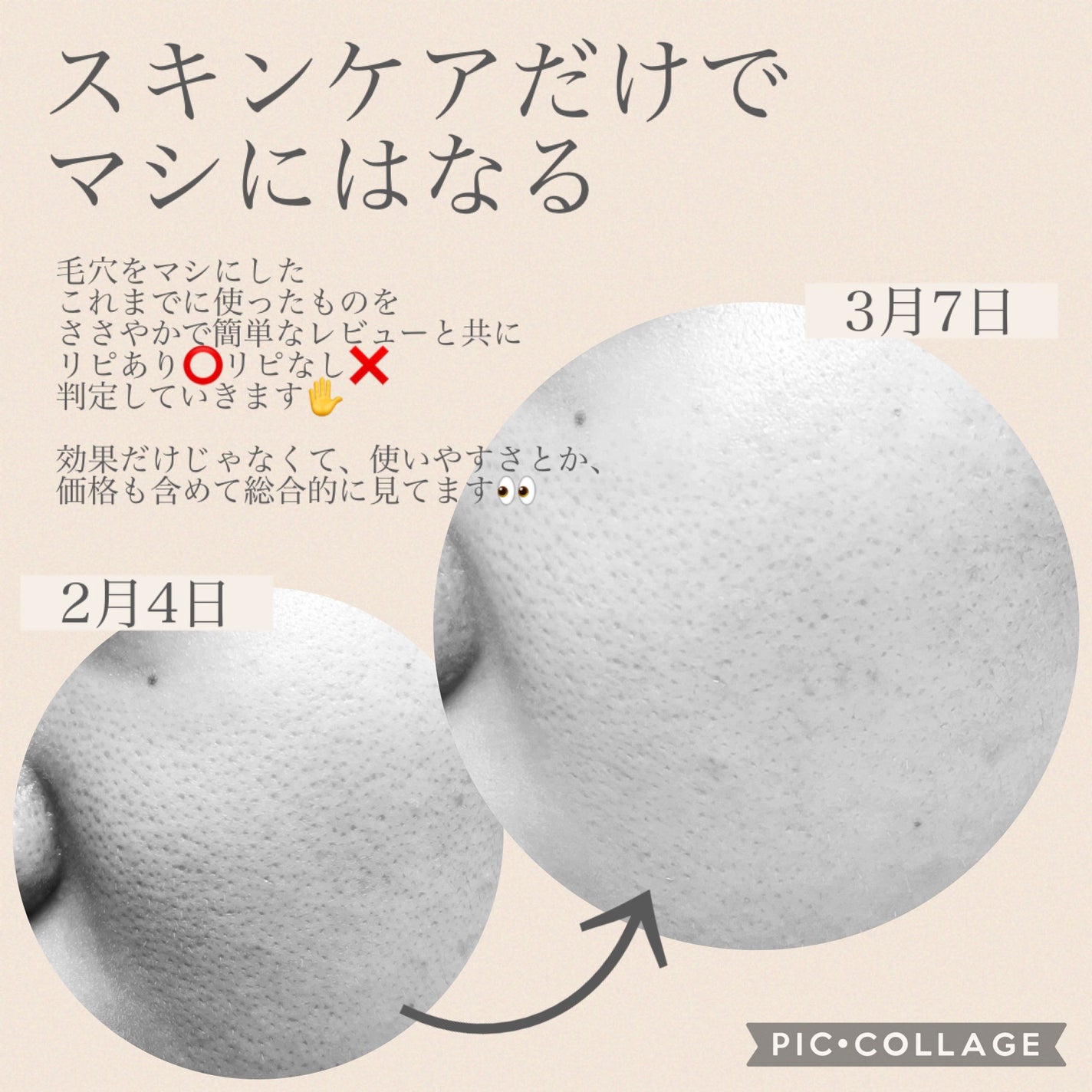 ハトムギ化粧水(ナチュリエ スキンコンディショナー R )/ナチュリエ/化粧水を使ったクチコミ(2枚目)