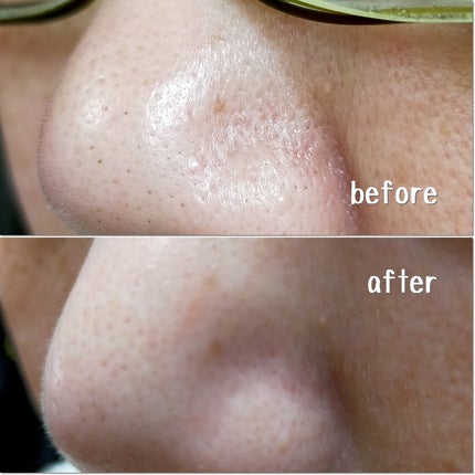 グリーントマトクレイマスククレンザー/FULLY/洗い流すパック・マスクを使ったクチコミ(4枚目)