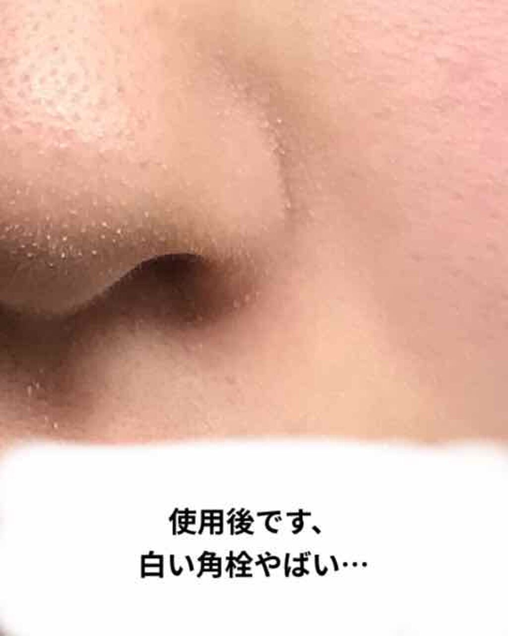 オバジC 酵素洗顔パウダー/オバジ/洗顔パウダーを使ったクチコミ（2枚目）