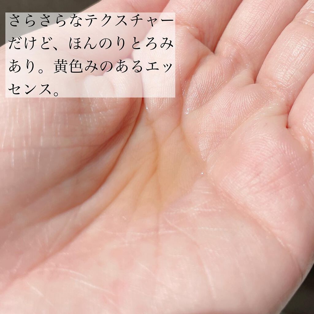 タカミエッセンスCE/タカミ/美容液を使ったクチコミ(2枚目)