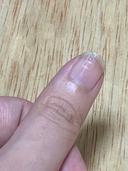 ネイル リペアセラム/ネイル リペアセラム/ネイルオイル・トリートメントを使ったクチコミ(4枚目)