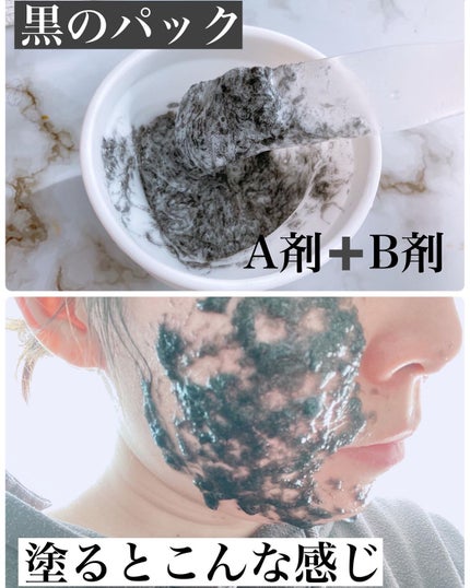 ニードル炭酸パック/NNE/洗い流すパック・マスクを使ったクチコミ(3枚目)