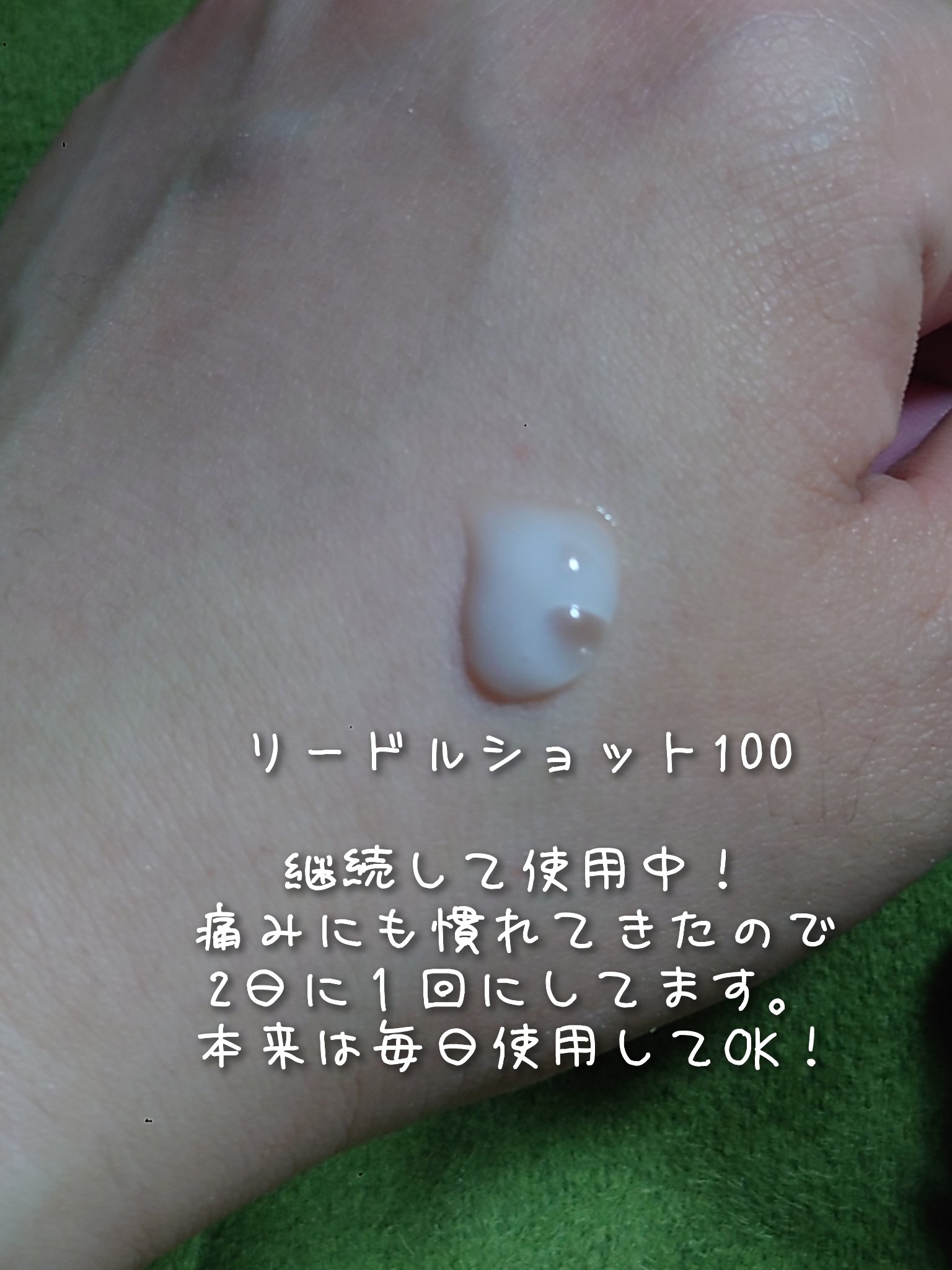 リードルショット リフティングセラム/VT/美容液を使ったクチコミ（2枚目）