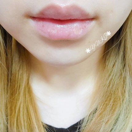 リップ クリーム/ちふれ/リップクリームを使ったクチコミ(5枚目)