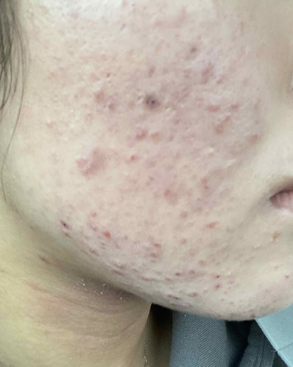 導入化粧液/無印良品/ブースター・導入液を使ったクチコミ（3枚目）