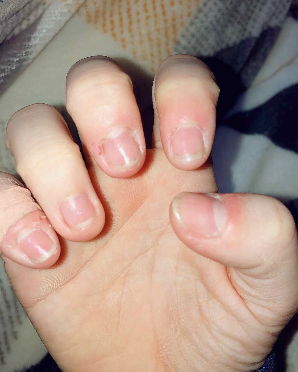 カラフルネイルズ ネイルハードナー/キャンメイク/ネイルトップコートを使ったクチコミ（3枚目）