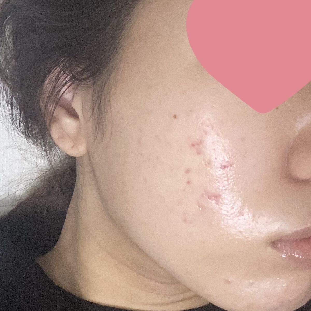 レチノールA 1% アドバンスドリバイタリゼーションクリーム/Life-flo/フェイスクリームを使ったクチコミ（2枚目）