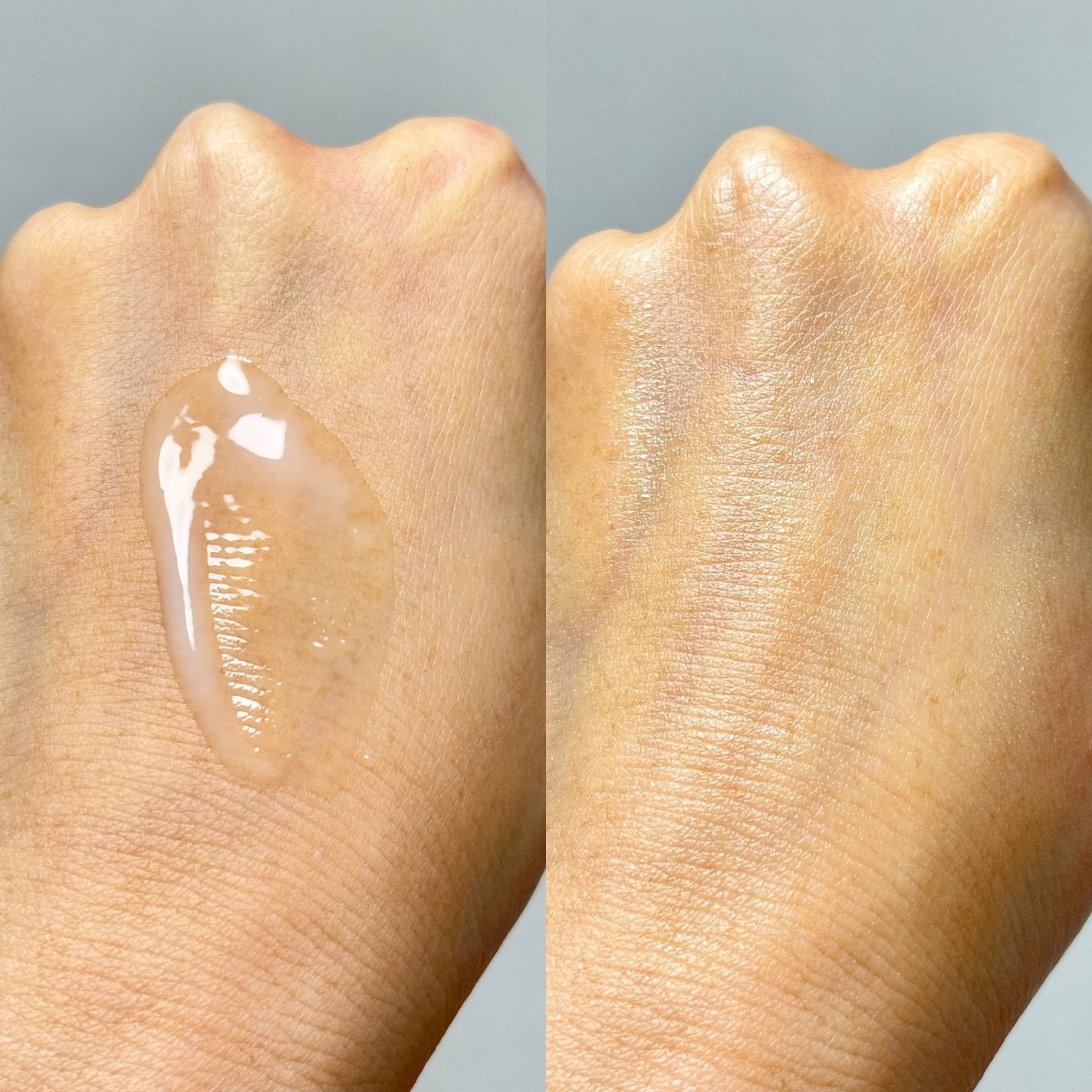 ポアマイジング フラッシュ アンプル/SKIN1004/美容液を使ったクチコミ(4枚目)