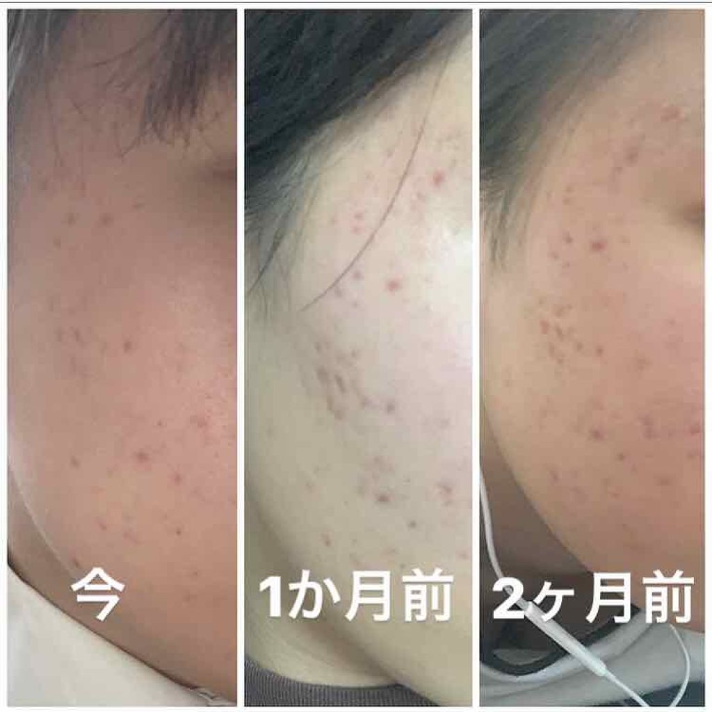 明色美顔水 薬用化粧水/美顔/化粧水を使ったクチコミ(2枚目)