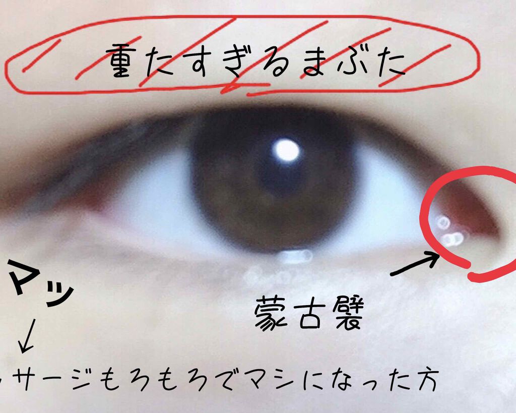 SH ダブルアイリッド/セリア/二重まぶた用アイテムを使ったクチコミ（3枚目）