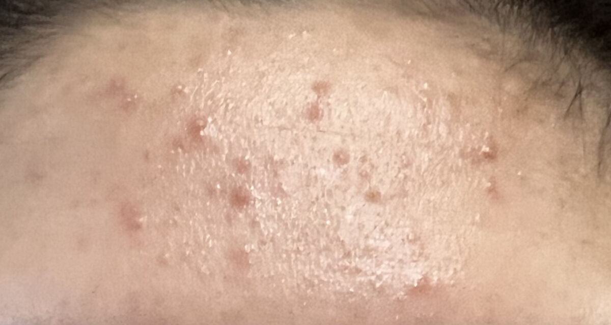 ハトムギ保湿ジェル(ナチュリエ スキンコンディショニングジェル)/ナチュリエ/美容液を使ったクチコミ（2枚目）