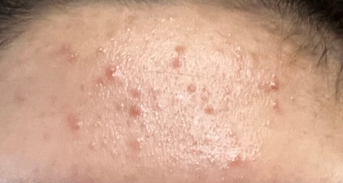 ハトムギ保湿ジェル(ナチュリエ スキンコンディショニングジェル)/ナチュリエ/美容液を使ったクチコミ(2枚目)