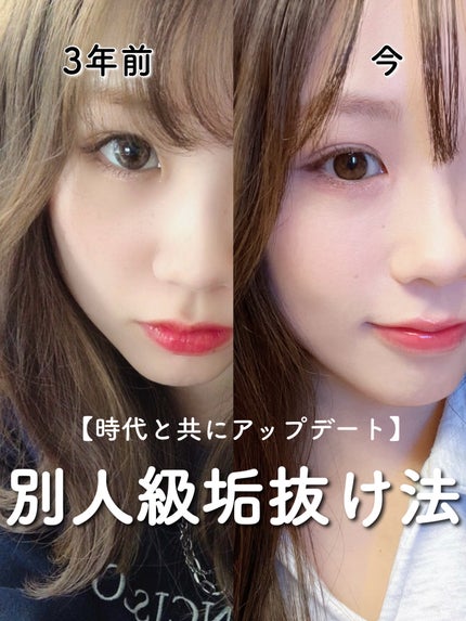 スポットメンテパウダー/muice/プレストパウダーを使ったクチコミ(1枚目)