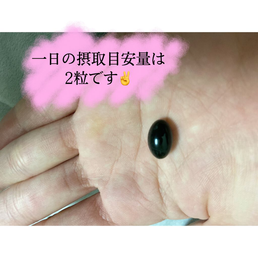 プレミアム生酵素カプセル/ボーテサンテラボラトリーズ/健康サプリメントを使ったクチコミ(2枚目)