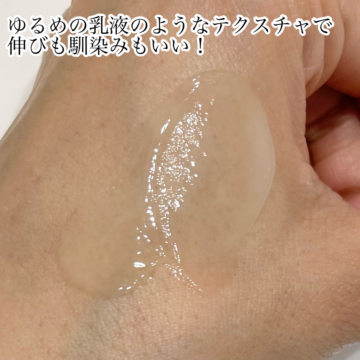 ビディ ニードルエッセンス NN/ビディ/美容液を使ったクチコミ（3枚目）