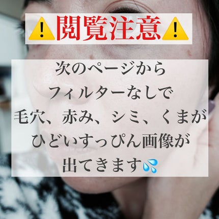 ピンクティーツリーカバークッション/APLIN/クッションファンデーションを使ったクチコミ(3枚目)