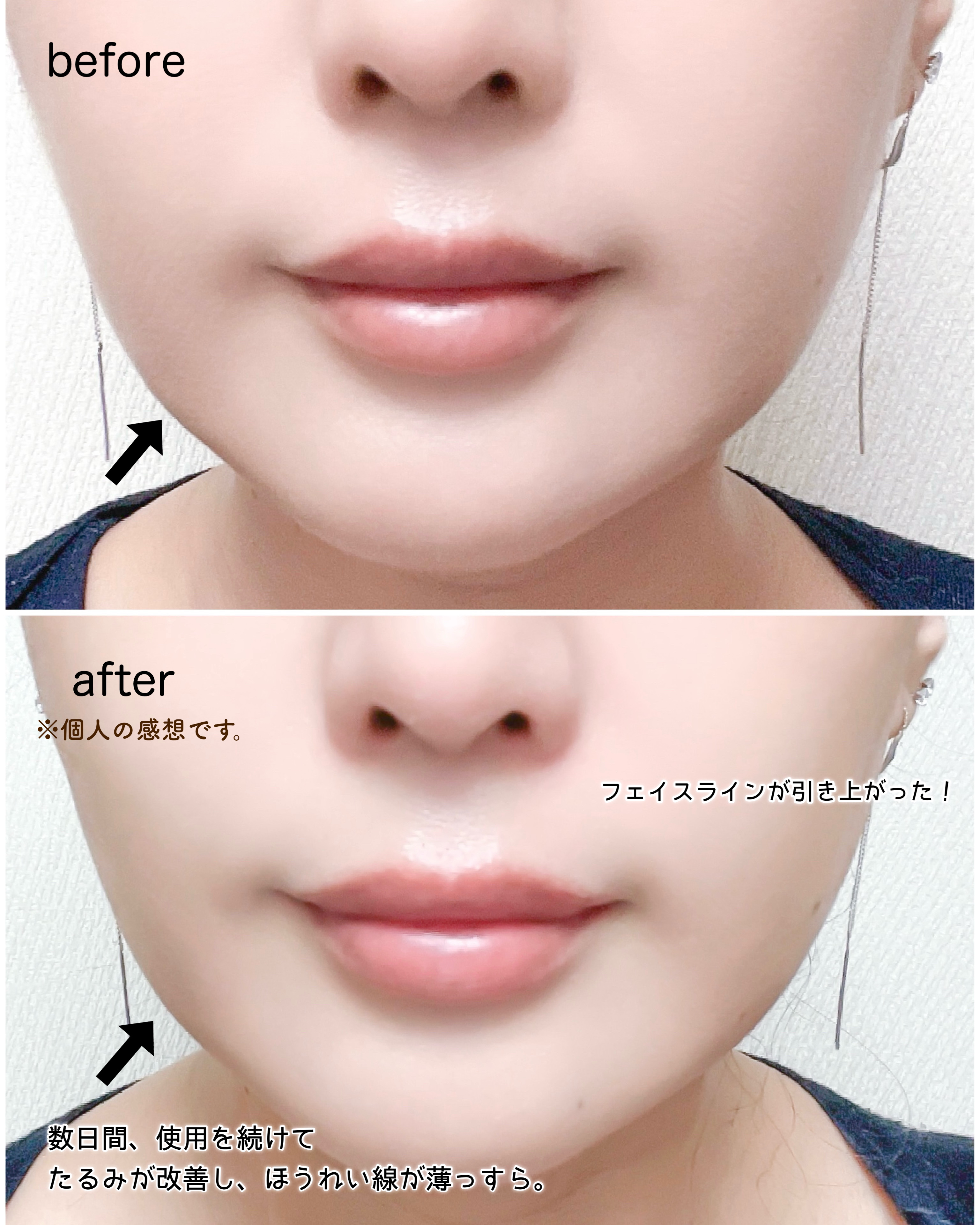 ローズフェイシャルローラー/SABON/美顔器・マッサージを使ったクチコミ（3枚目）