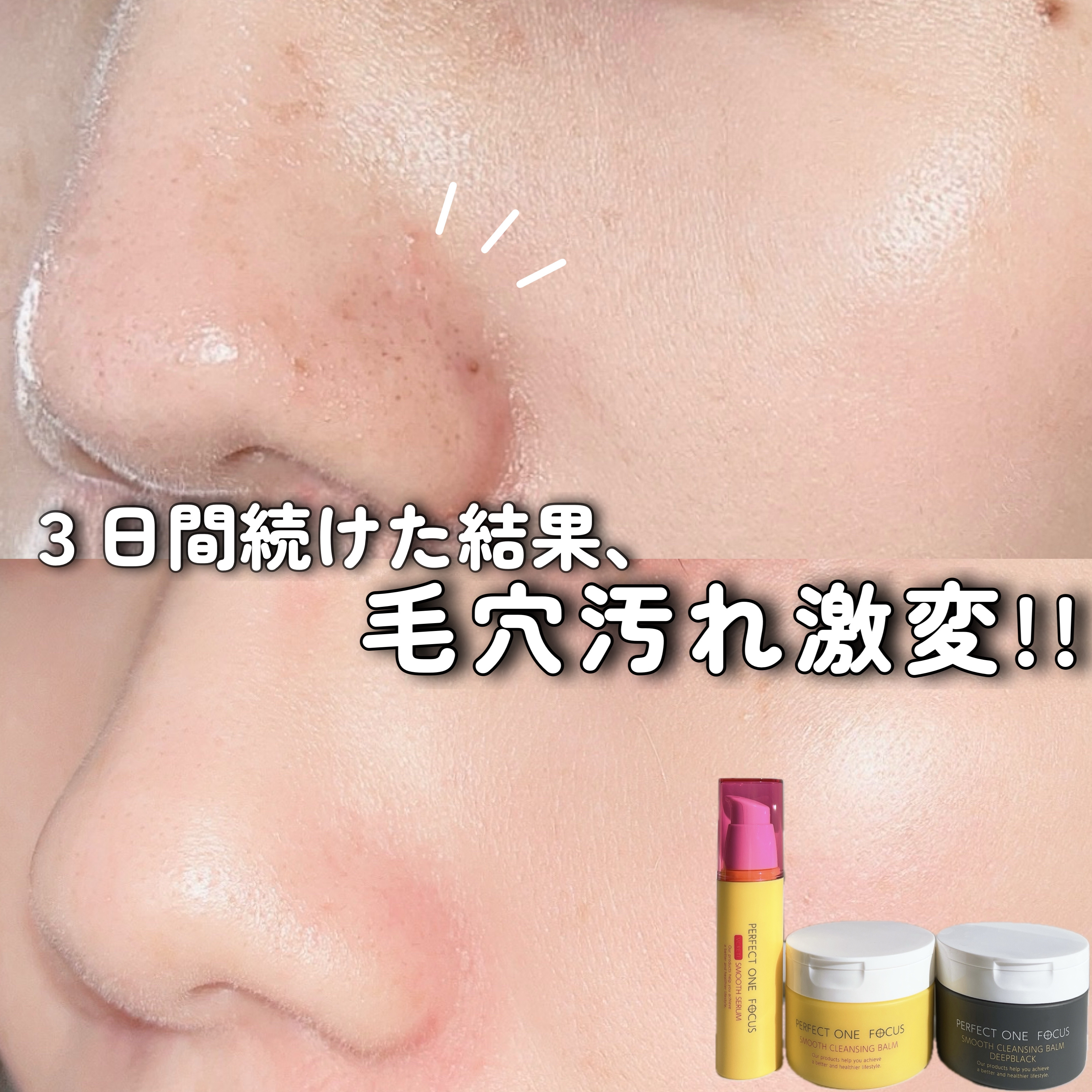 パーフェクトワンフォーカス VCレチ スムースセラム/PERFECT ONE  FOCUS/美容液を使ったクチコミ（1枚目）