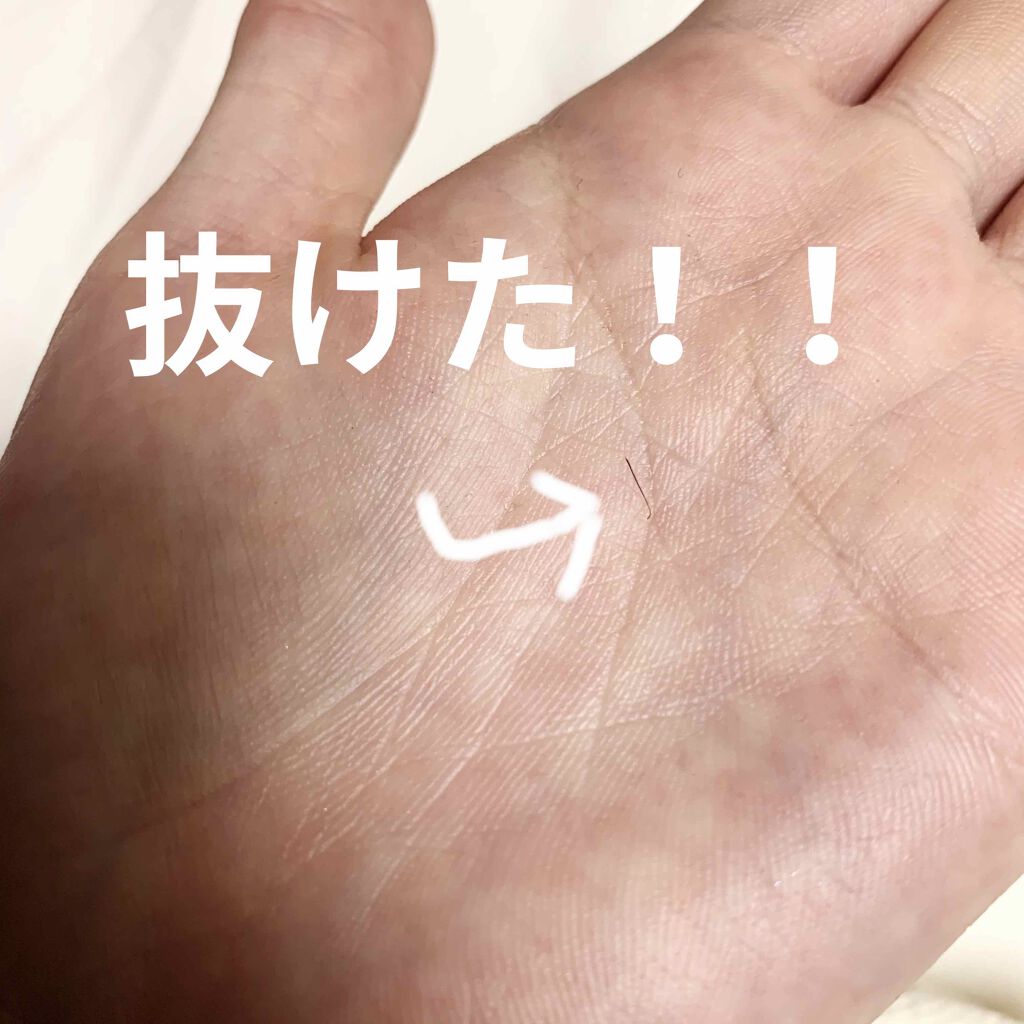 光脱毛器 VIO/Sarlisi/家庭用脱毛器を使ったクチコミ(3枚目)