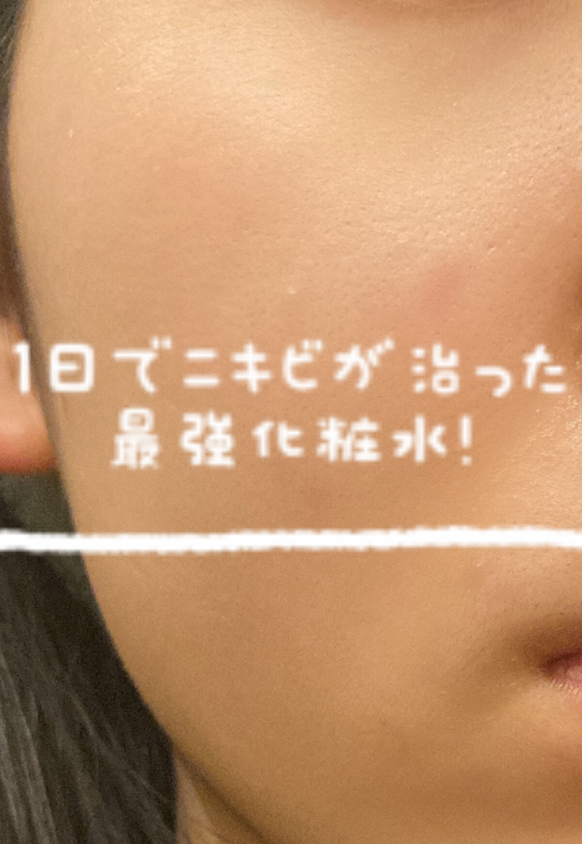 インビジブルピーリングブースターエッセンス/CNP Laboratory/ブースター・導入液を使ったクチコミ（1枚目）