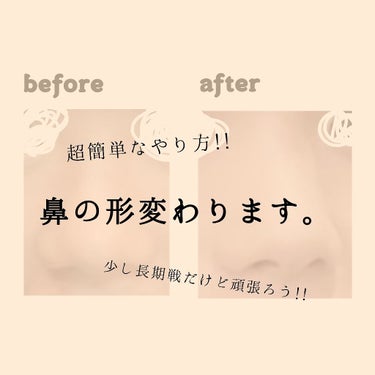 だんご鼻解消

こんにちは!!ちろるです!!

今回は  りおさんのお悩み
「だんご鼻」これ私も悩みだったんですよ😅

ですが写真分かりずらくてすみません!!
でも何となく真ん中がスッとしたのがわかって