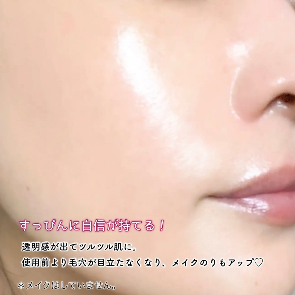 ダーマスキンピーリング/BQCELL/その他キットセットを使ったクチコミ(6枚目)