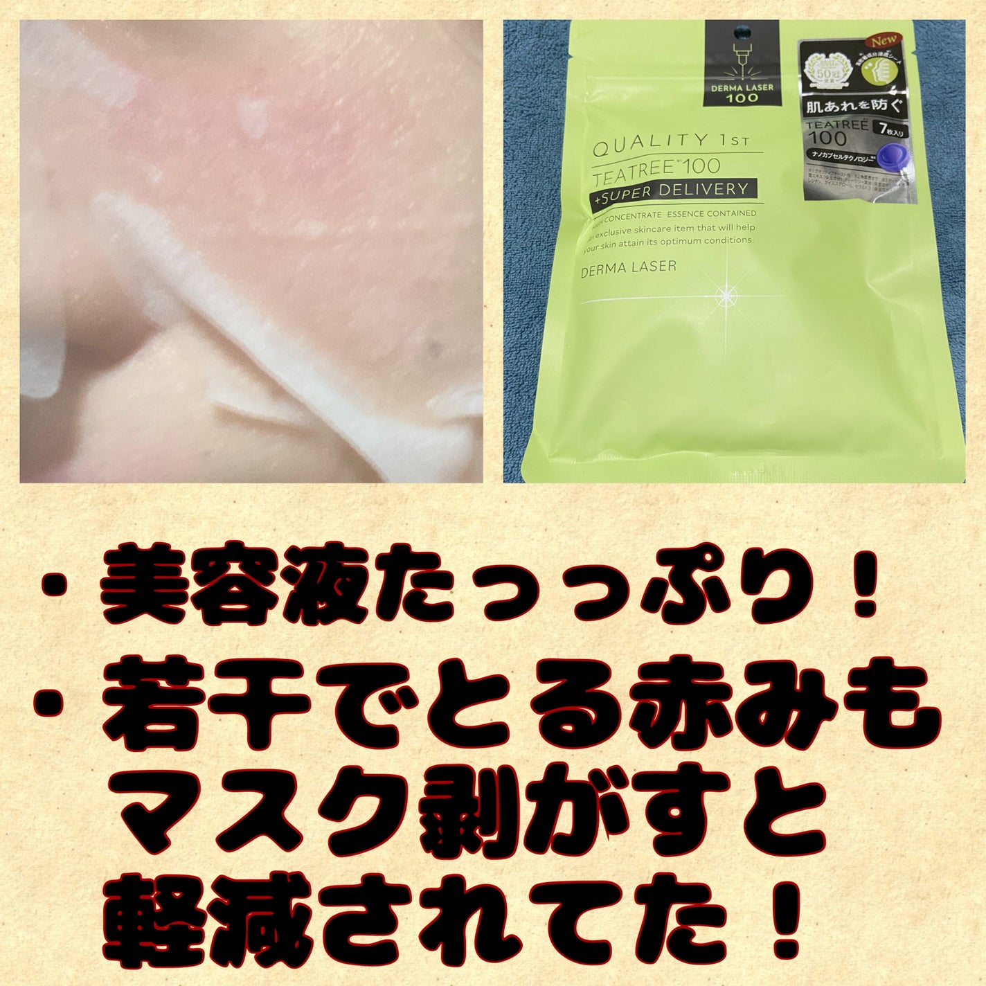 ダーマレーザー スーパーTEATREE100マスク/クオリティファースト/シートマスク・パックを使ったクチコミ(2枚目)