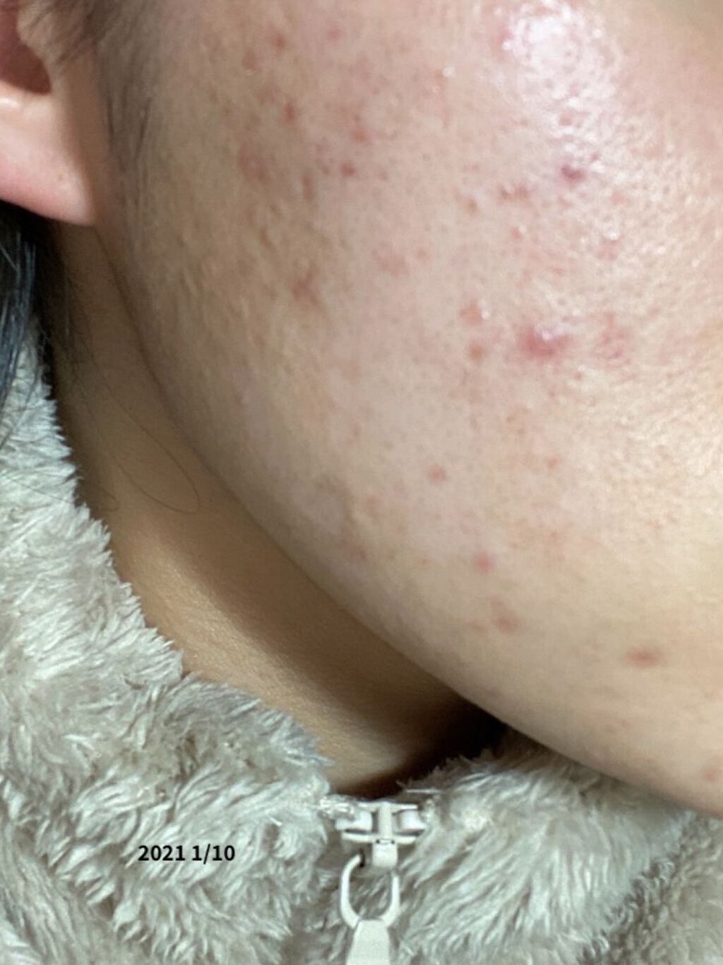 化粧水・敏感肌用・高保湿タイプ/無印良品/化粧水を使ったクチコミ（2枚目）