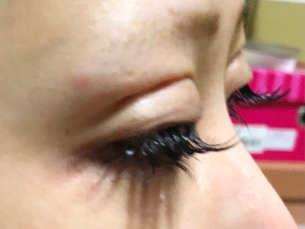 aikam on LIPS 「メイク動画upする前に…私、2回、整形しております。1回目20..」(4枚目)