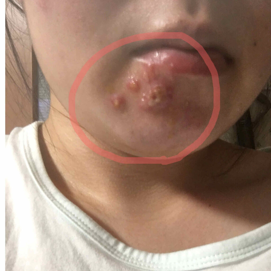 を使ったクチコミ（2枚目）