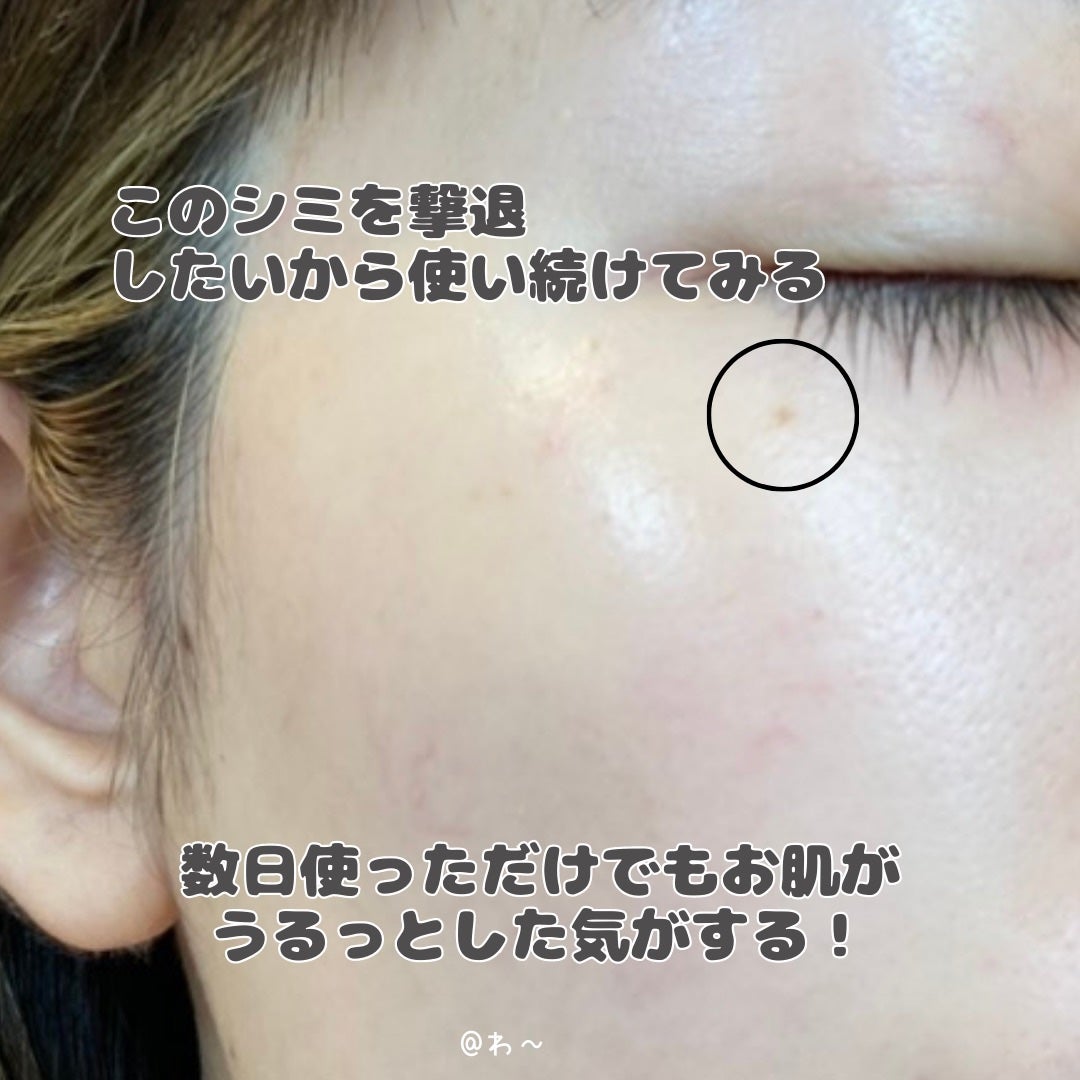 C+クリアセラム/ヴィオテラス/美容液を使ったクチコミ(7枚目)