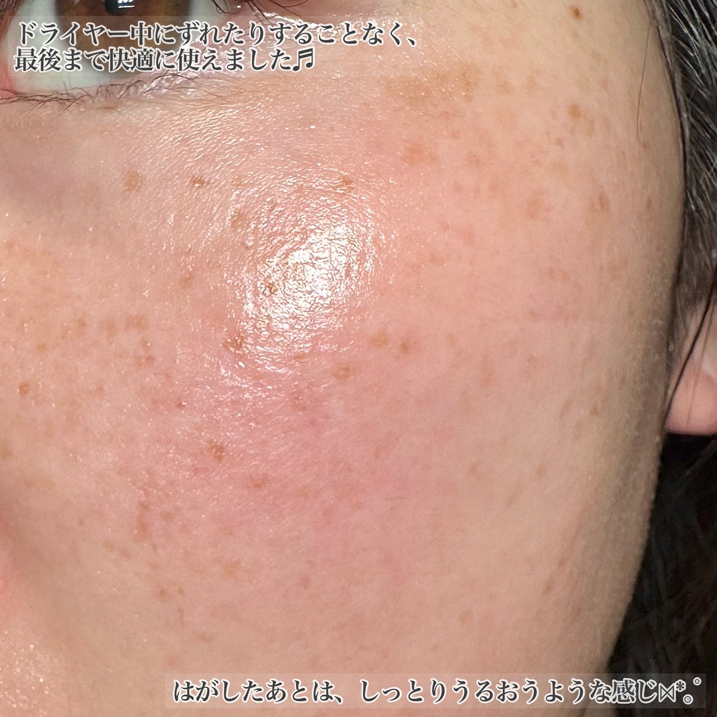 潤いバリアセラムマスク N/ももぷり/シートマスク・パックを使ったクチコミ(5枚目)