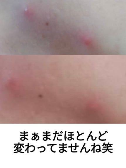 メンズビオレ ザフェイス 毛穴汚れクリア/メンズビオレ/泡洗顔を使ったクチコミ(2枚目)