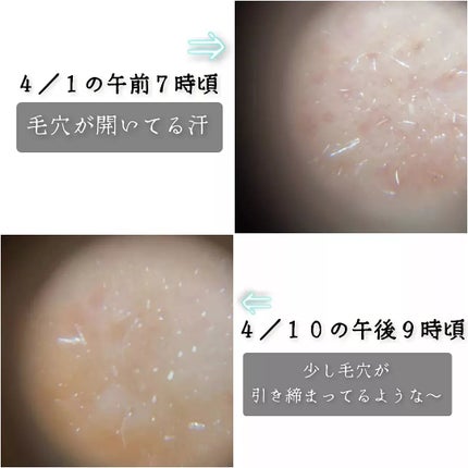 ピーディーアールエヌエッセンス PDRN 100/VT/美容液を使ったクチコミ(3枚目)