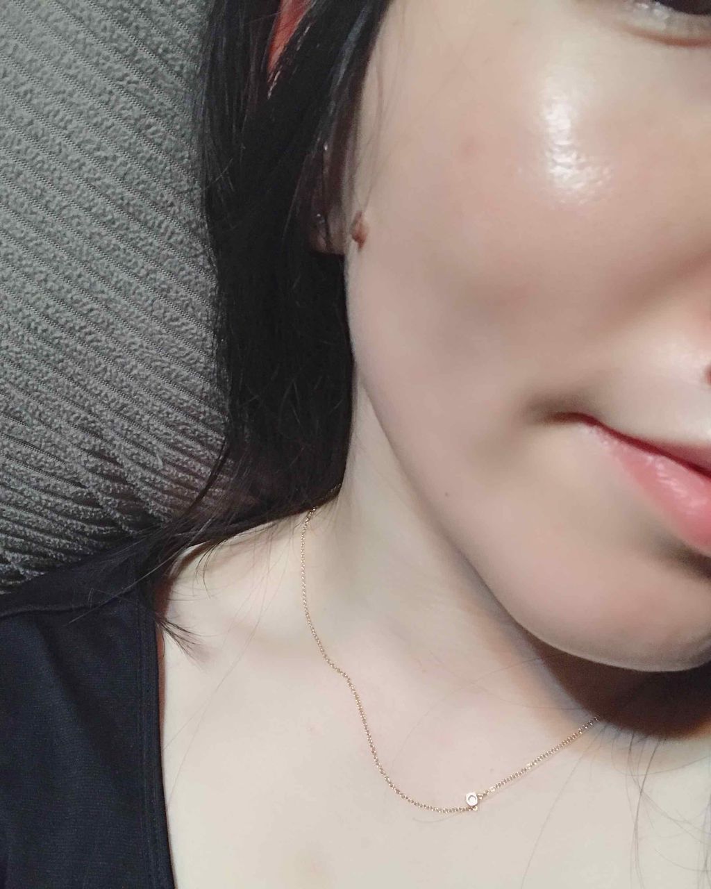 美容原液 オパール R-III/薬用 オパールR-Ⅲ/美容液を使ったクチコミ(3枚目)