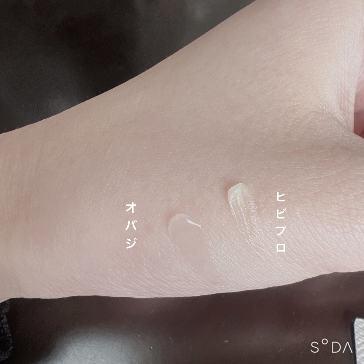 ヒビプロLP(医薬品)/メンソレータム/その他を使ったクチコミ（2枚目）