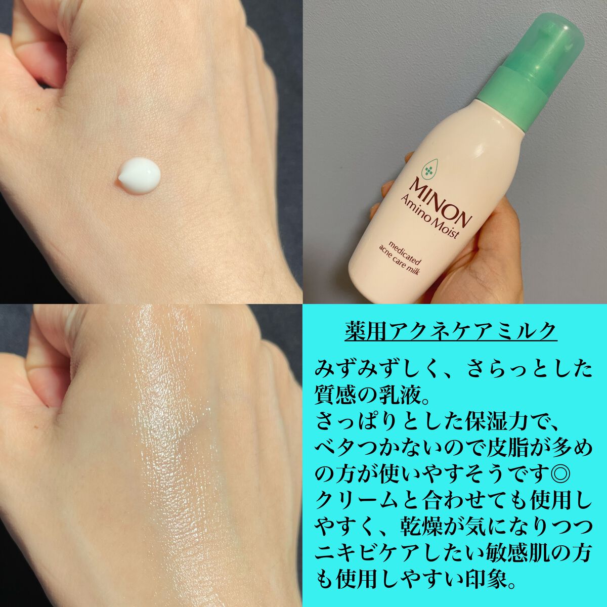 ミノン アミノモイスト 薬用アクネケア ローション/ミノン/化粧水を使ったクチコミ（3枚目）