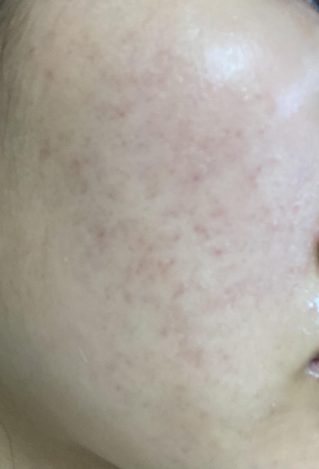 ミノン アミノモイスト モイストチャージ ミルク/ミノン/乳液を使ったクチコミ（2枚目）