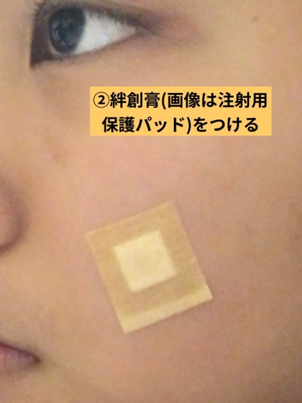 からしちゃん on LIPS 「どうもっからしです。今回は、厄介な赤ニキビ・黄ニキビをたった数..」(3枚目)