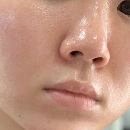 プロポリスB5グローバリアカミングクリーム/SOME BY MI/フェイスクリームを使ったクチコミ(6枚目)