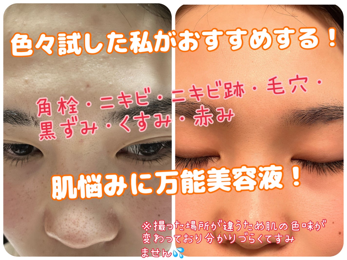 RXザ・ビタミンC23セラム/COSRX/美容液を使ったクチコミ(1枚目)