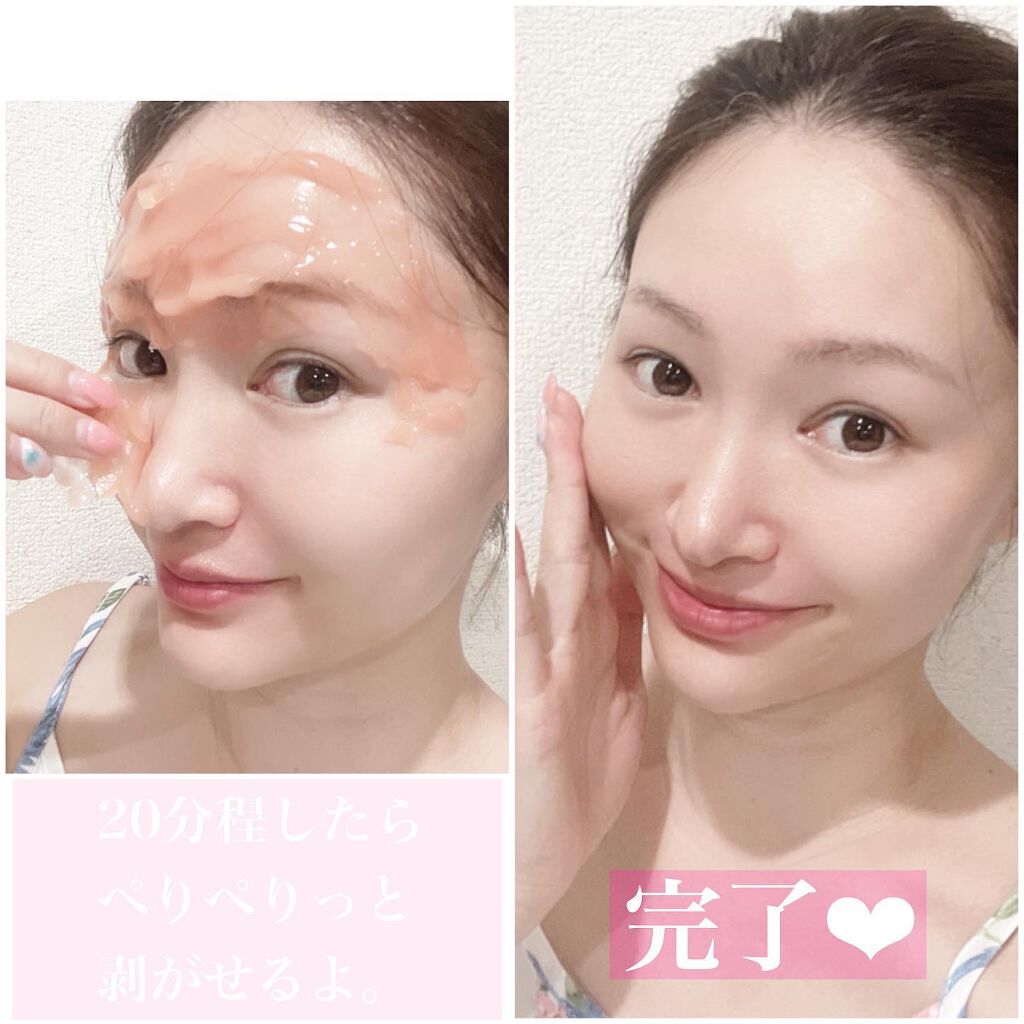 CO2 Gel Pack Pro 3P/10P/BELA VELA/シートマスク・パックを使ったクチコミ（3枚目）