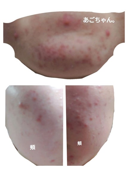 を使ったクチコミ(3枚目)